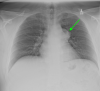 Fig 1 –