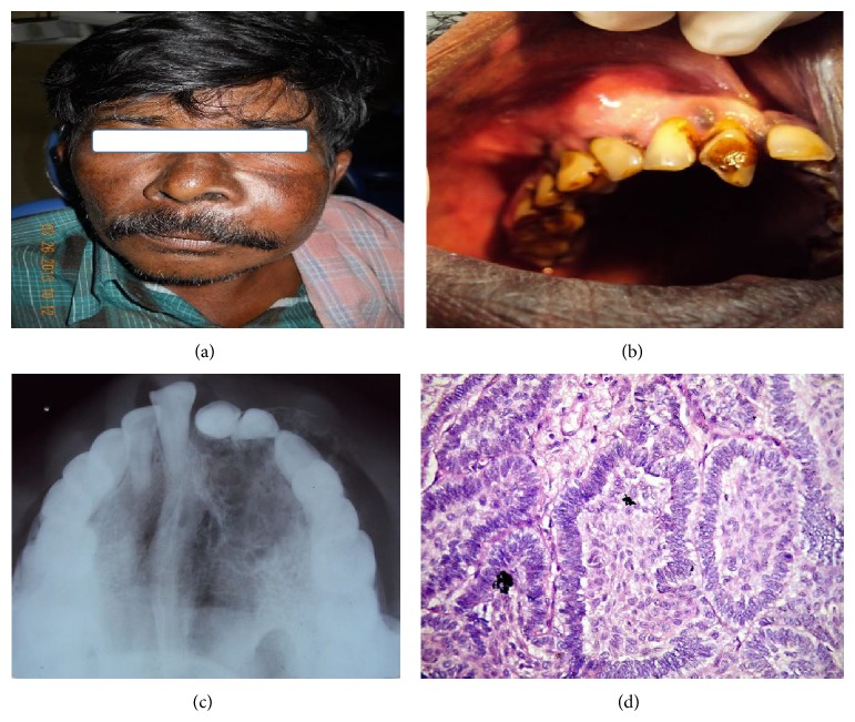 Figure 4