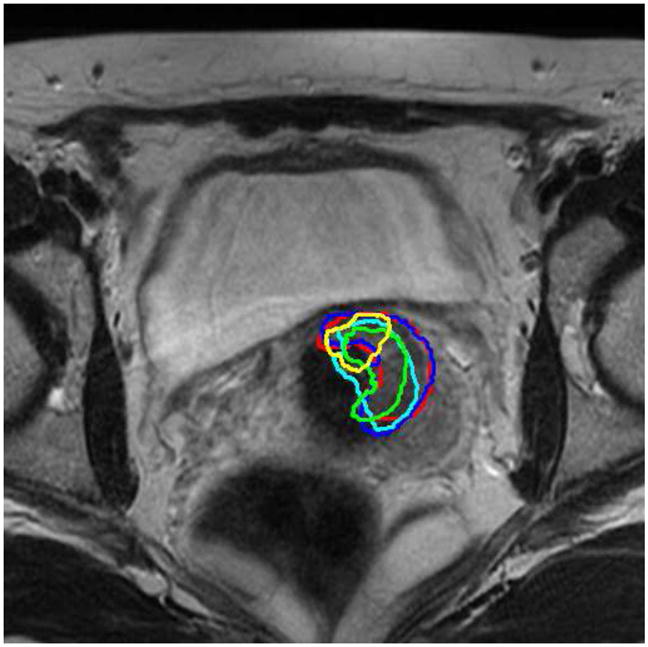 Figure 19