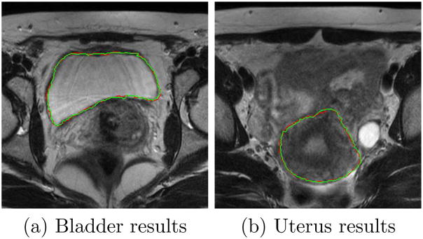 Figure 14