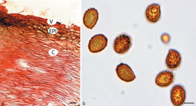 Fig. 18