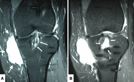 Fig. 2A−B