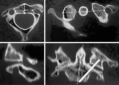 Fig. 1