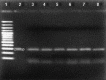 Figure-1