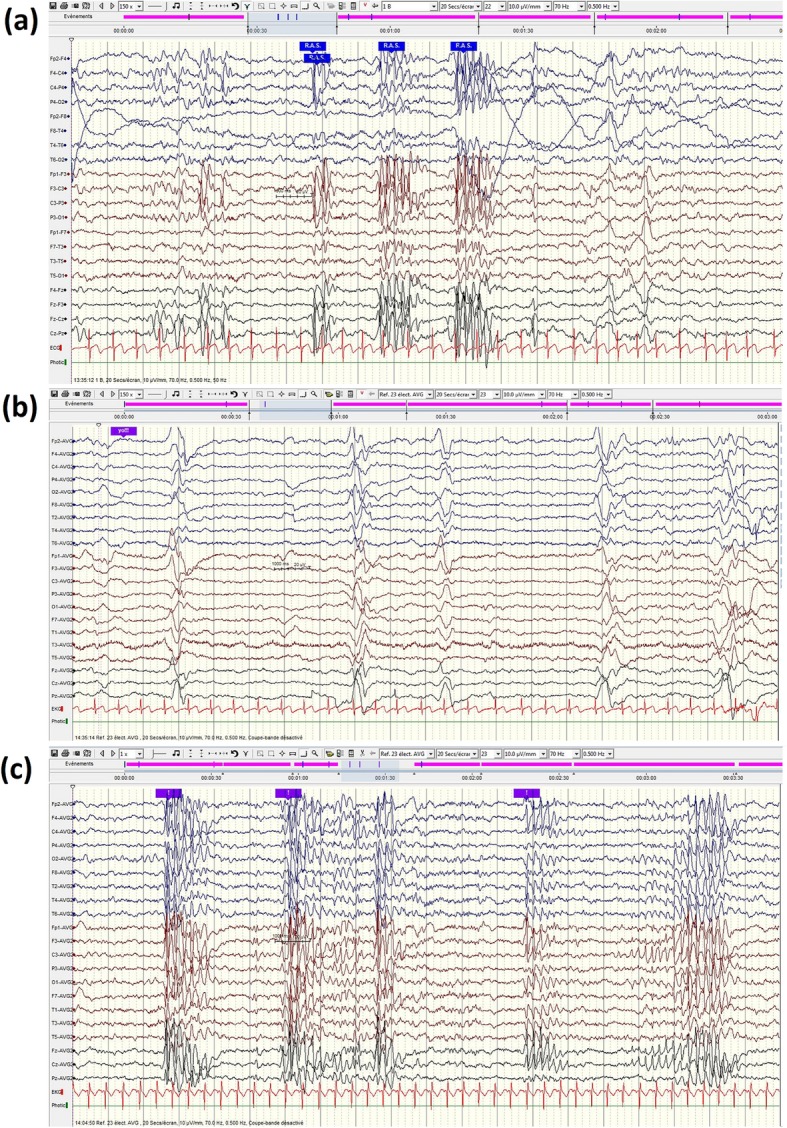 Fig. 3