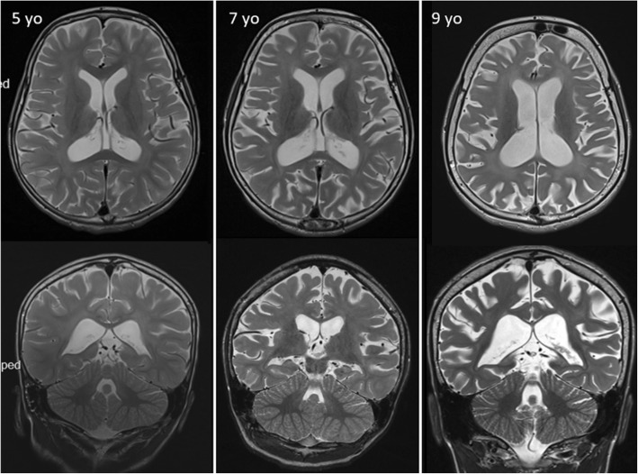 Fig. 2