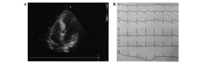 Figure 2.