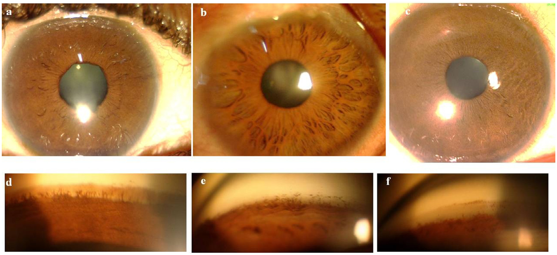 Figure 1 –