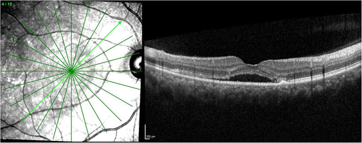 Fig. 4