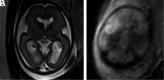 FIG 3.