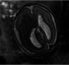 FIG 4.
