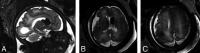 FIG 2.