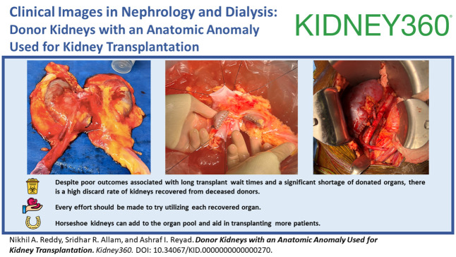 graphic file with name kidney360-5-170-g001.jpg