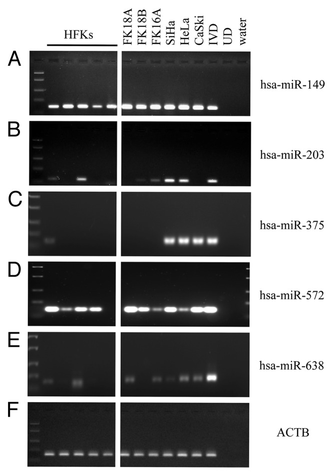 graphic file with name epi-8-220-g1.jpg