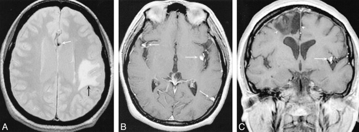 fig 2.