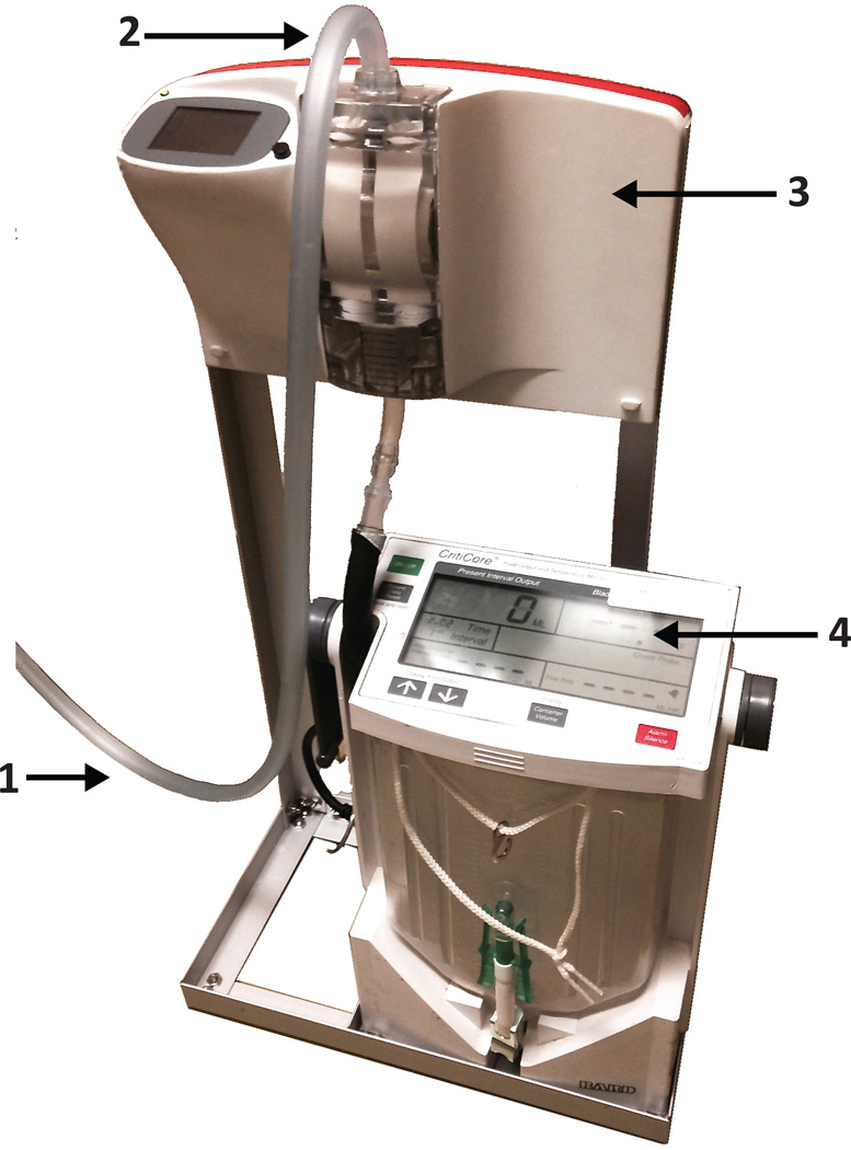 Inaccuracy of Urine Output Measurements due to Urinary Retention in ...