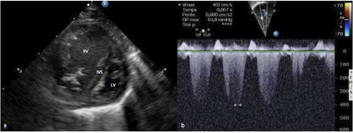 FIGURE 2