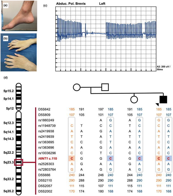 FIGURE 1