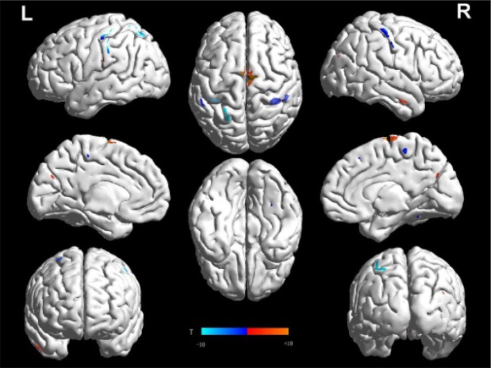 Fig. 2