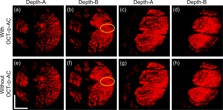 Fig. 11