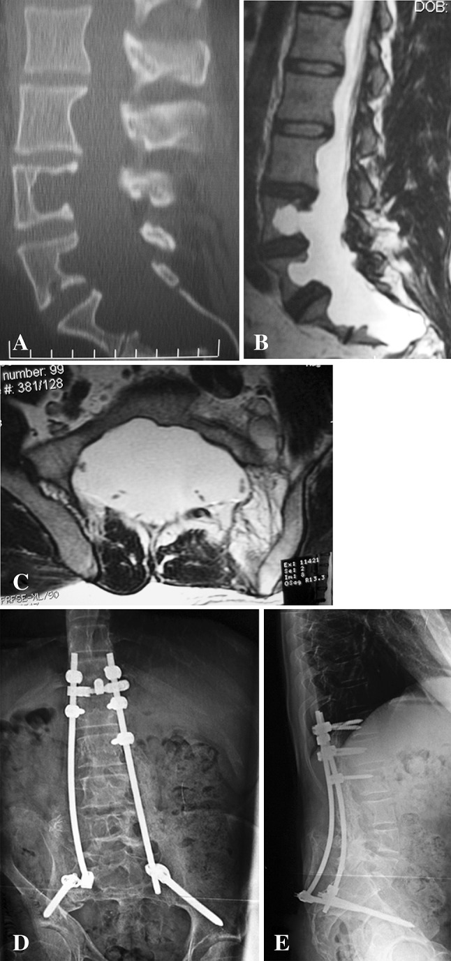 Fig. 2A–E