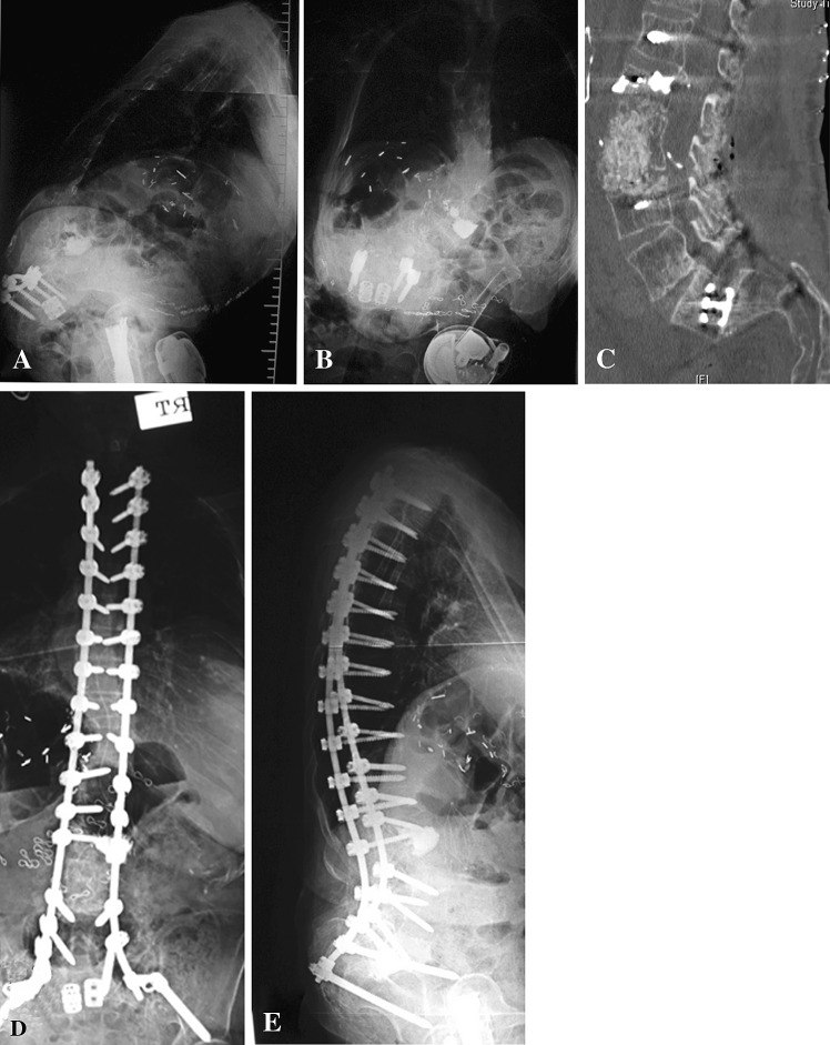 Fig. 1A–E