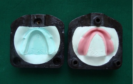 Figure 6: Denture Flask after trial closure for Microwave Curing.