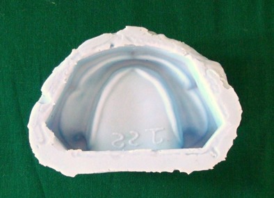 Figure 1: Standard Mandibular Edentulous Silicone Mold.