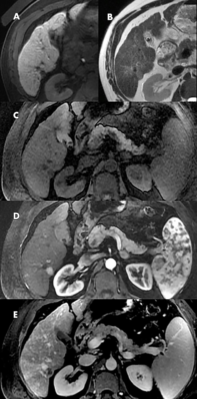 Figure 4: