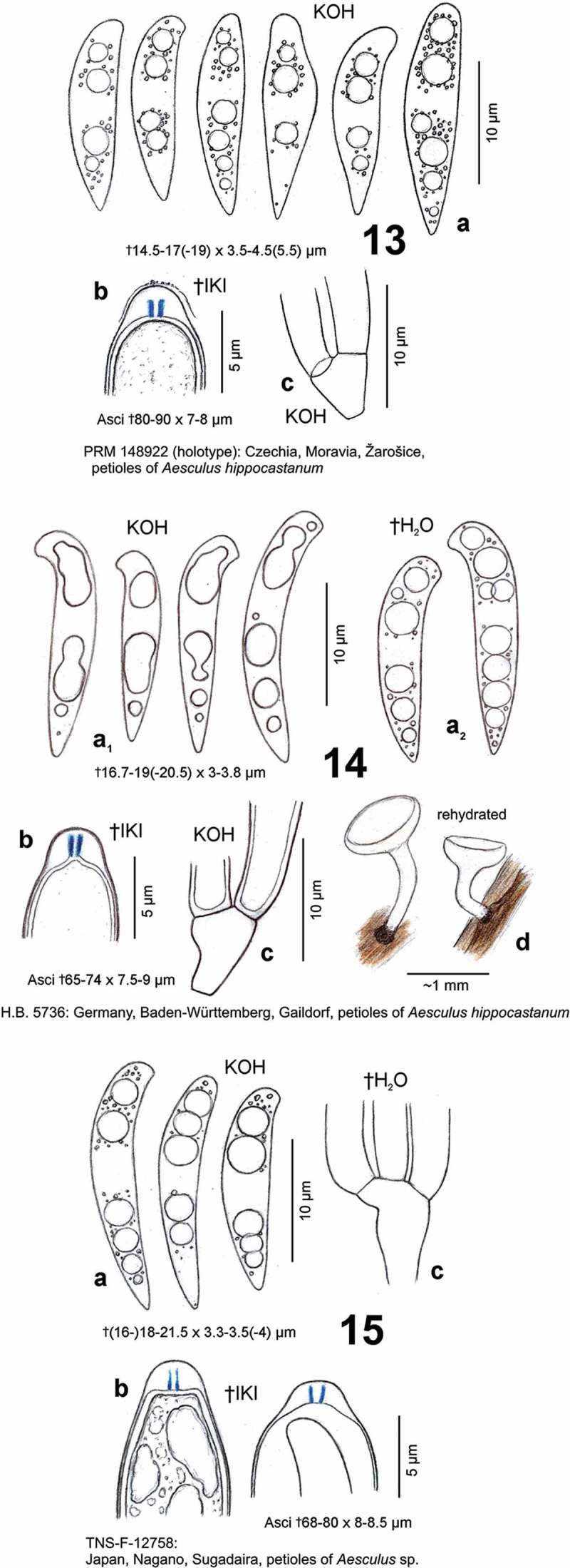 Figures 13–15. 