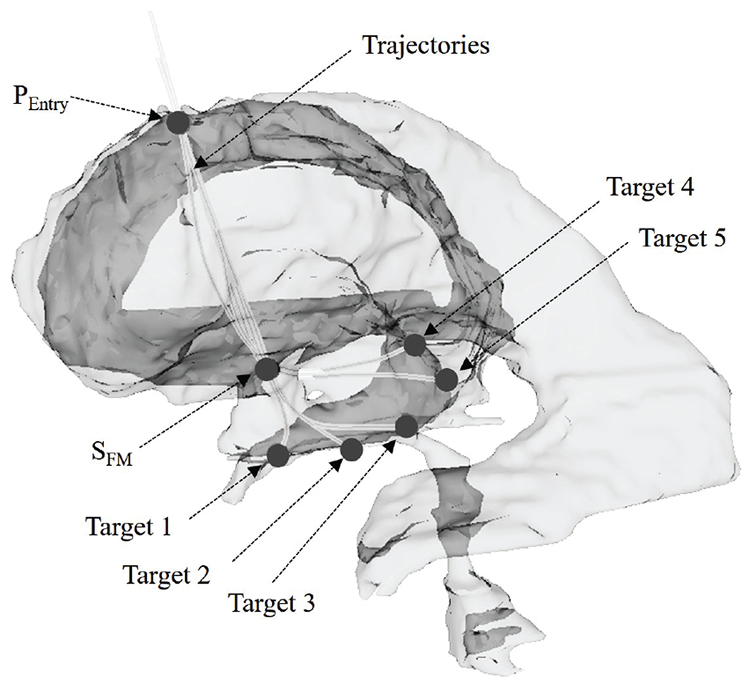 Fig. 12.