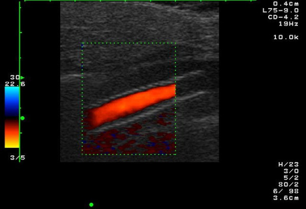 Figure 9