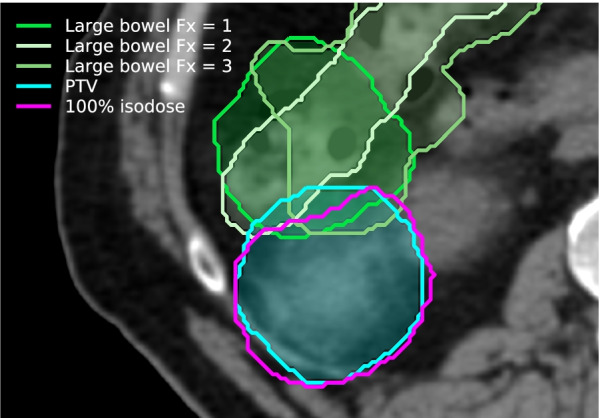 Fig. 5