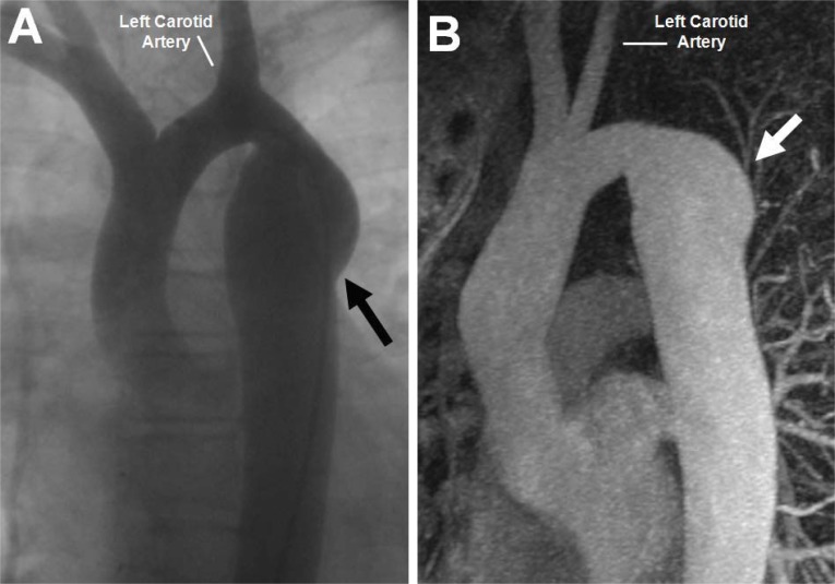 Fig. (4)