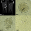 Fig. 1