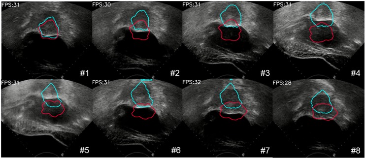 Figure 11