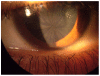 Figure 22