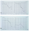 Figure 21