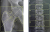 Figure 24