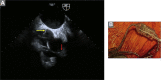 Supplemental Figure S3