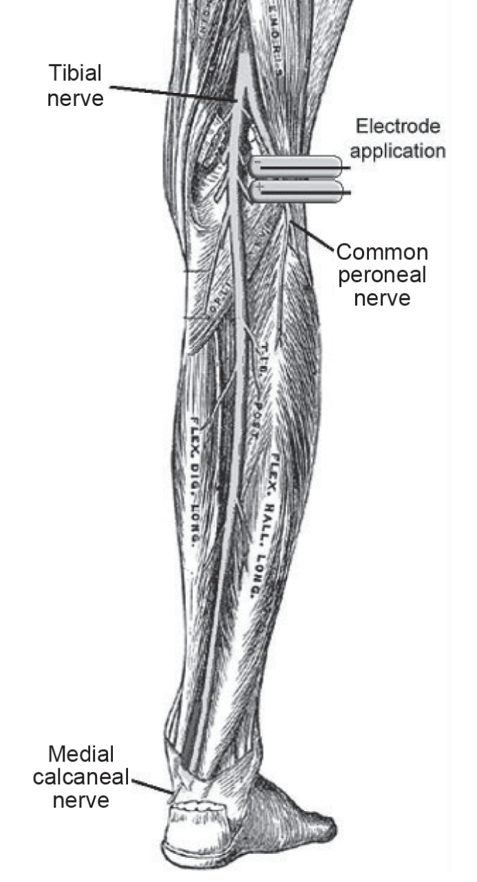 Figure 1)