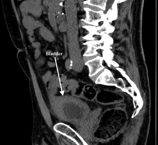 Figure 2