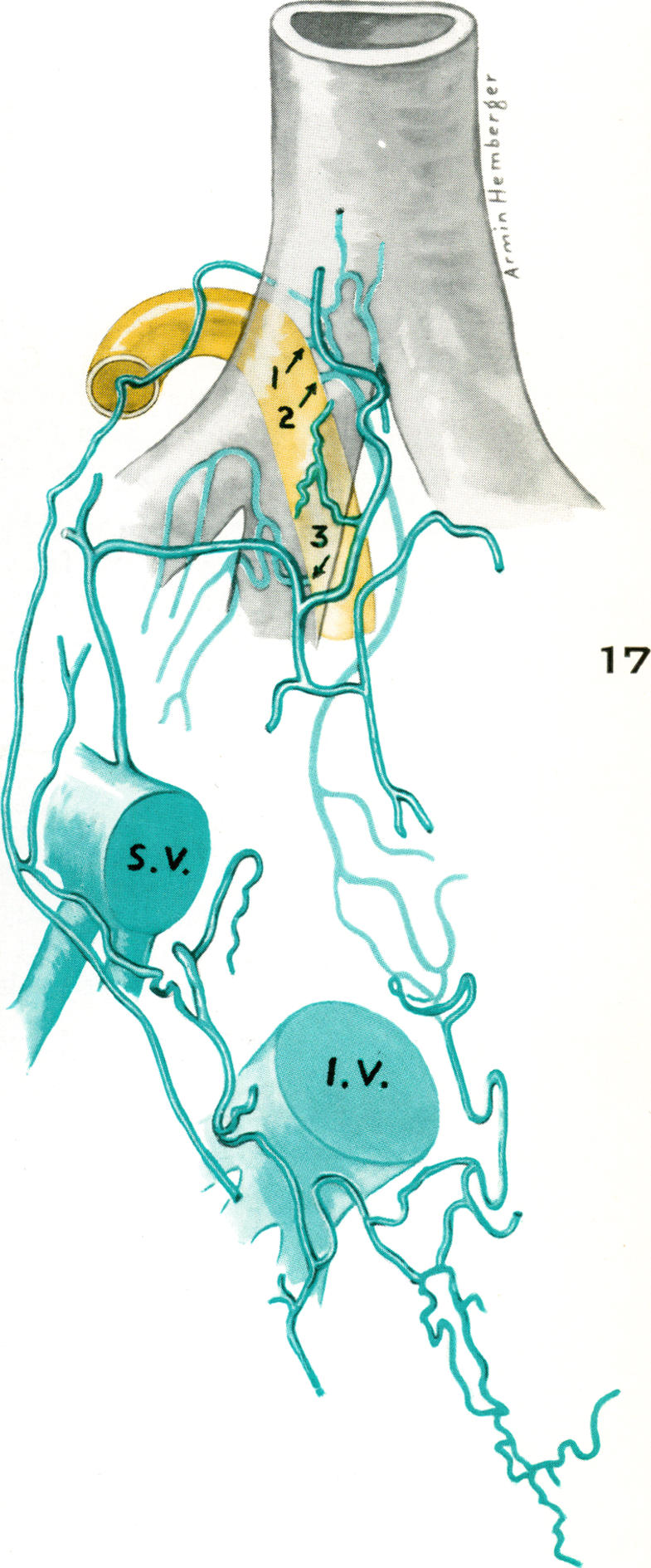 Fig. 17