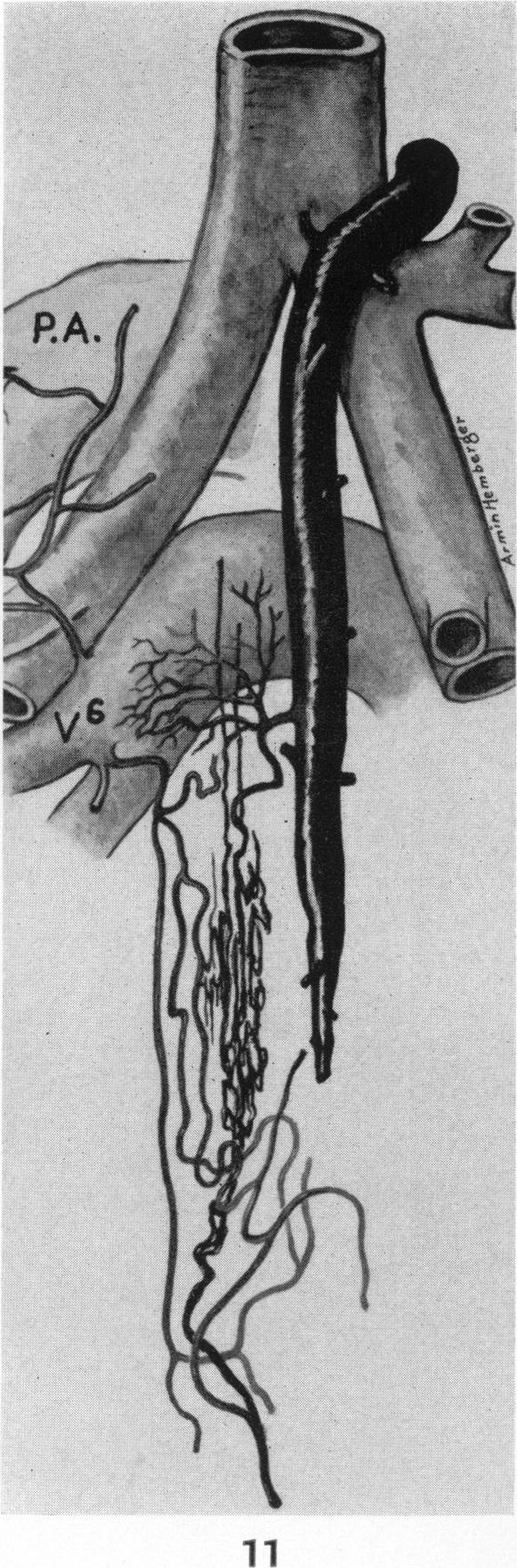 Fig. 11