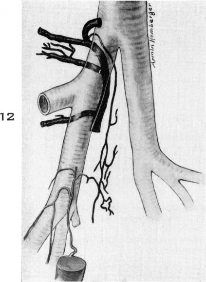 Fig. 12