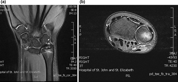 Fig. 5