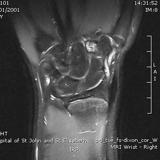 Fig. 4