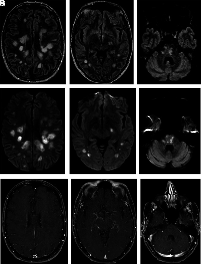 FIG 1.