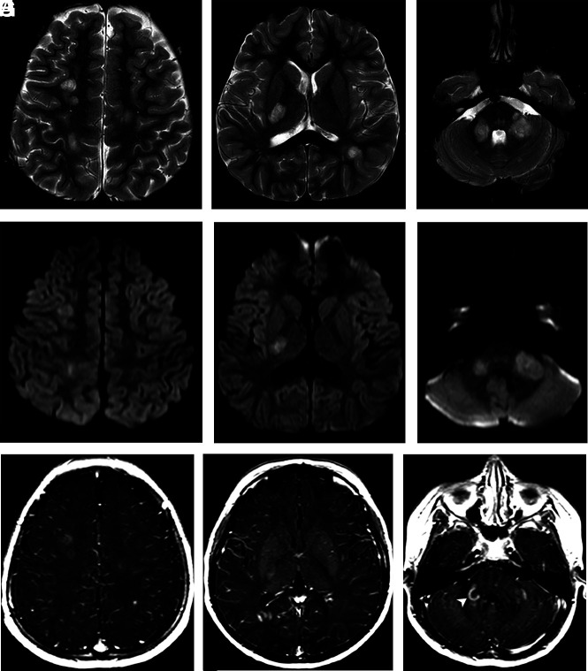 FIG 2.