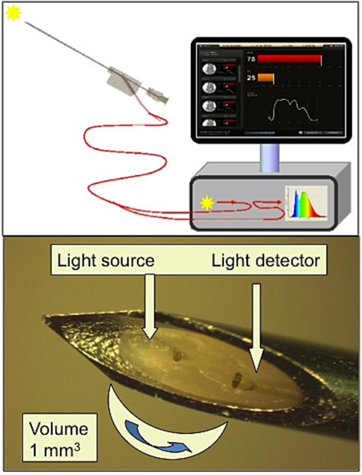 Fig 2